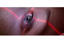 Göze Lazer Tedavisi