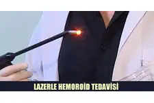 Hemoroid Lazer Tedavisi